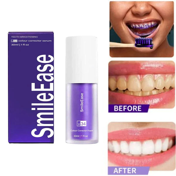 🦷🪥SMILE EASE: BLANQUEADOR DENTAL🦷🪥